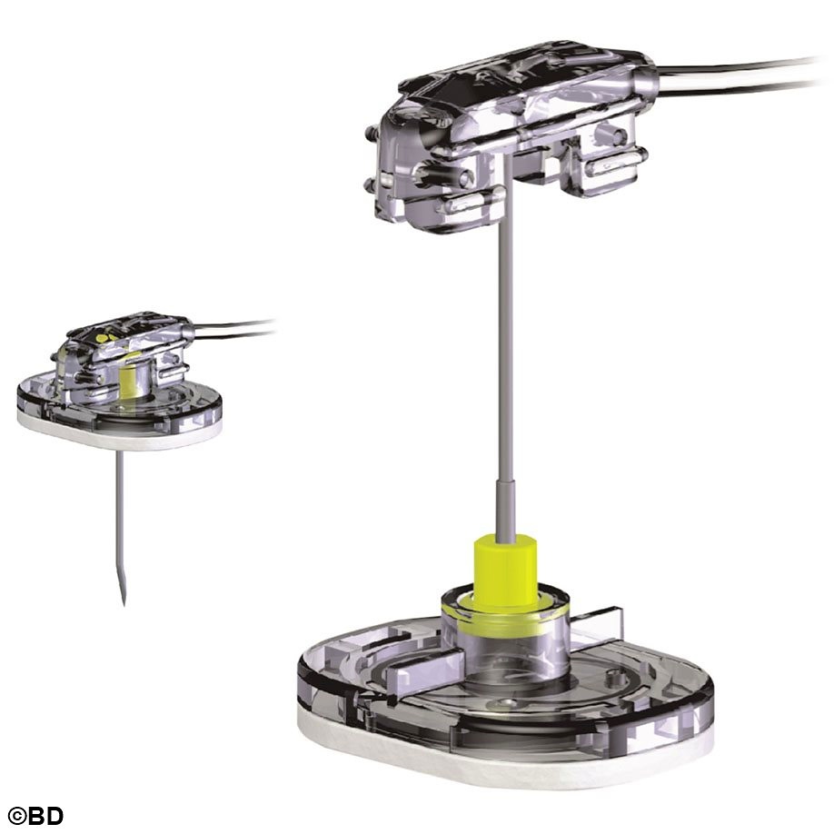 SafeStep Huber Nadelset zur Portpunktion Ohne Y-Adapter, 22 G 19 mm (25 Stck.)