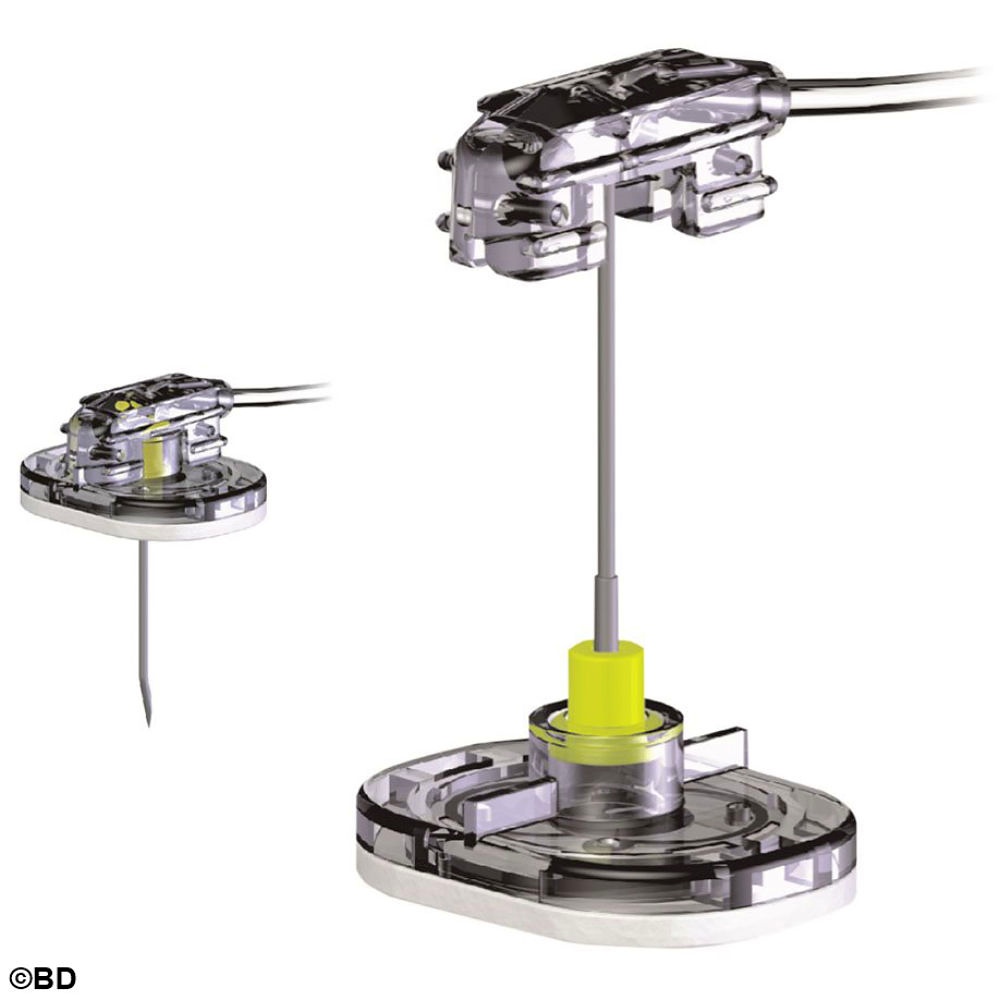 SafeStep Huber Nadelset zur Portpunktion Ohne Y-Adapter, 20 G 38 mm (25 Stck.)