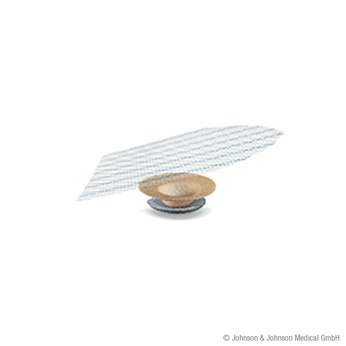 [ETH UPPL1] ULTRAPRO Hernien-Plug groß MONOCRYL-PROLENE