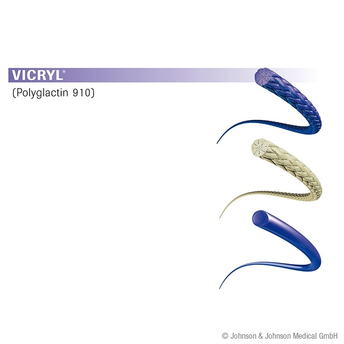VICRYL 5/0=1 violett geflochten Nahtmaterial Fadenlänge 3 x45cm(36 Stck)