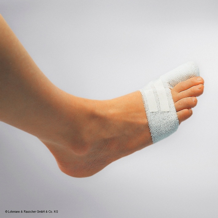 [LOH 11485] Raucolast elastische Fixierbinden 4 m x 10 cm, lose (20 Stck.)