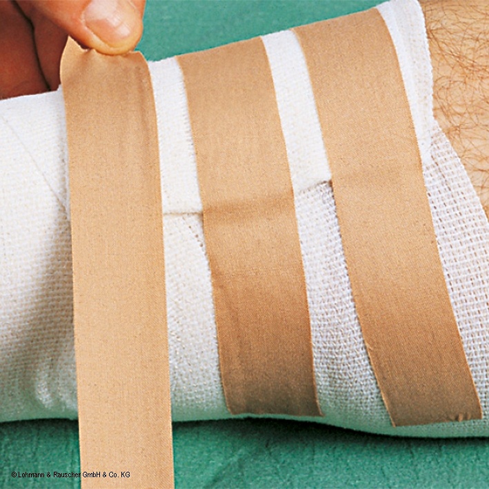 Porofix Heftpflaster hautfarben 5 m x 1,25 cm