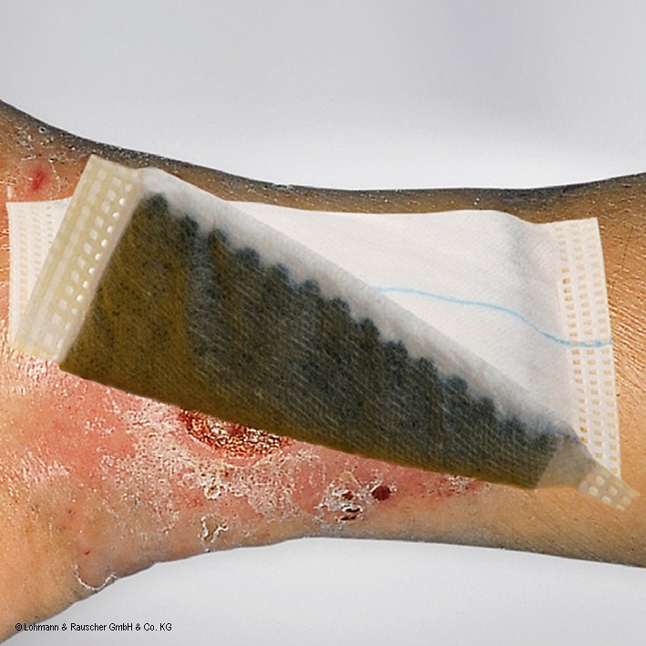 [LOH 20706] Vliwaktiv Ag Aktivkohle-Saugkompressen Mit Silber,steril, 10 x 20 cm (10 Stck.)