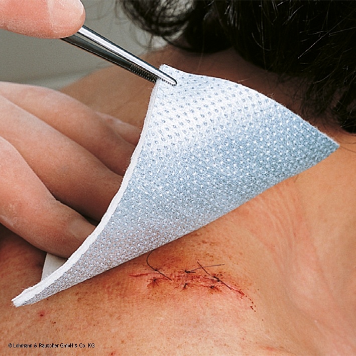 [LOH 23081] Metalline Kompressen steril 8 x 10 cm (50 Stck.)