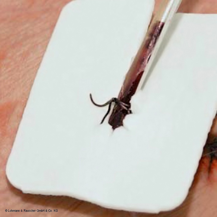 [LOH 23093] Metalline Drain-Kompressen steril 6 x 7 cm (50 Stck.)