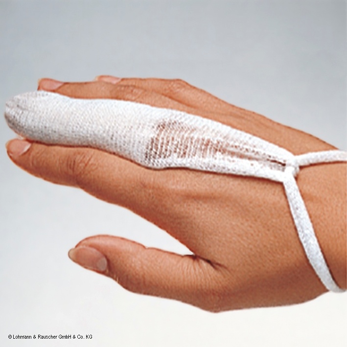 [LOH 24081] Tg-Fingerlinge (50 Stck.)