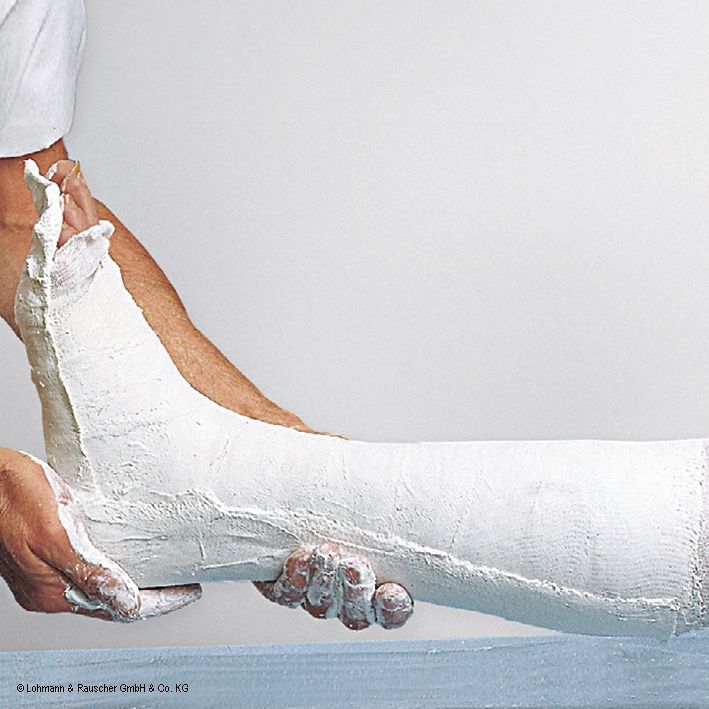 [LOH 25502] Cellona Longuette 4-fach 20 m x 15 cm