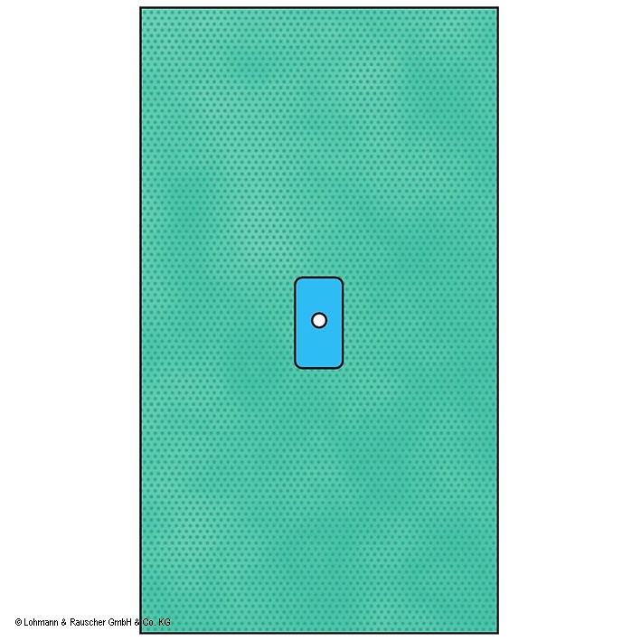 [LOH 33082] Raucodrape PRO Extremitätentücher Hand/Fuß steril, 225 x 300 cm (10 Stck.)