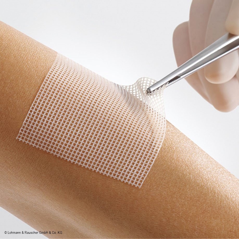 Lomatuell PRO Polyesterfaser-Gittertüll Steril, 5 x 5 cm (8 Stck.)