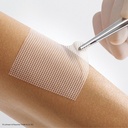 Lomatuell PRO Polyesterfaser-Gittertüll Steril, 5 x 5 cm (8 Stck.)