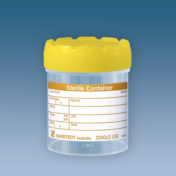 Mehrzweck-Becher 70 ml mit montiertem Schraubverschluss gelb (200 Stck.)