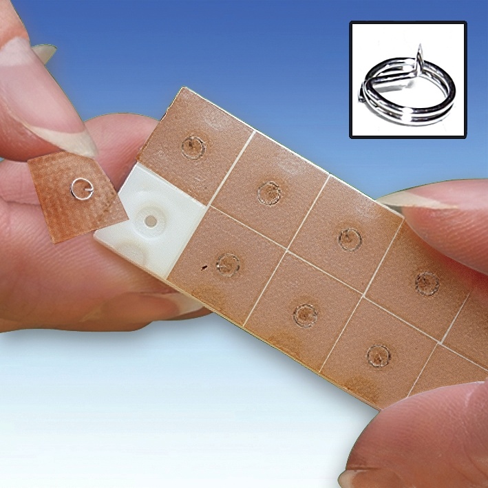 Ohr-Dauernadeln ratiomed 0,25 x 1,0 (10 x 10 Stck.)