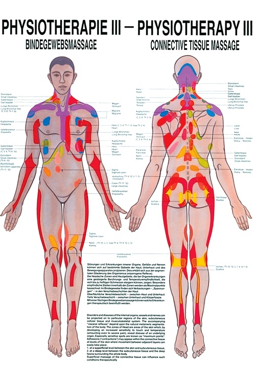 [RÜD PHYSIII] Anat. Poster: Physiotherapie Bindegewebsmassage, 50 x 70 cm, Papier