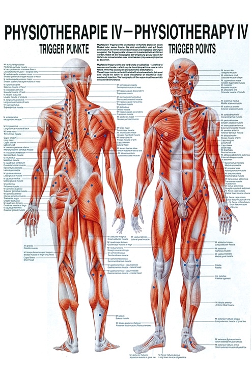 [RÜD PHYSIV] Anat. Poster: Physiotherapie Triggerpunkte, 50 x 70 cm, Papier