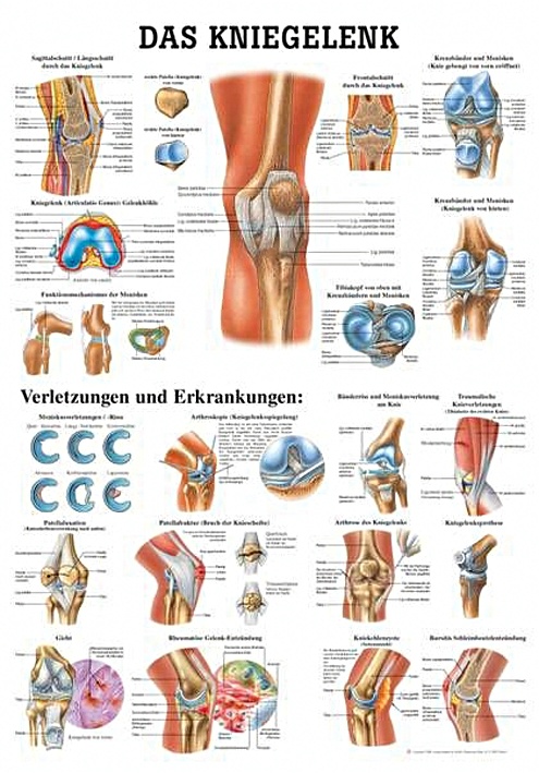 [RÜD TA33] Anat. Lehrtafel: Das Kniegelenk 70 x 100 cm, Papier