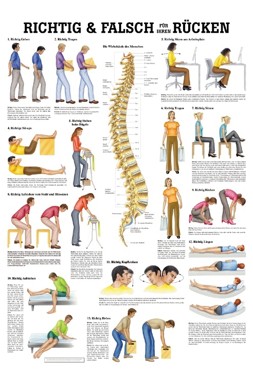 Anatomische Lehrtafel: Richtig & Falsch für Ihren Rücken